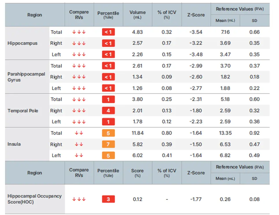 AQUA brain atrophy report