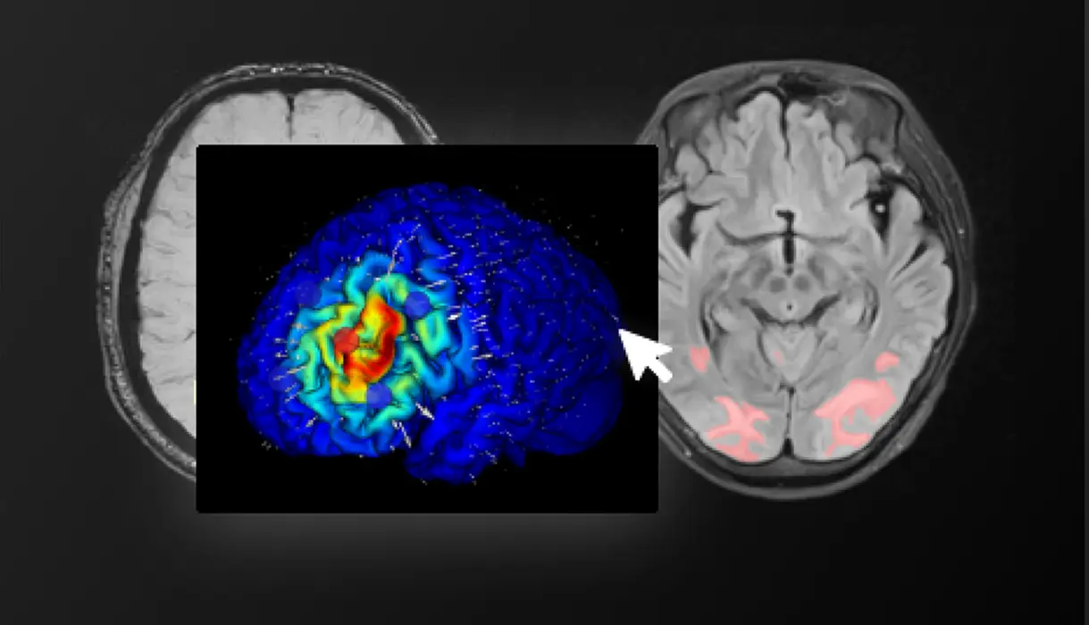 Neurophet tES LAB
