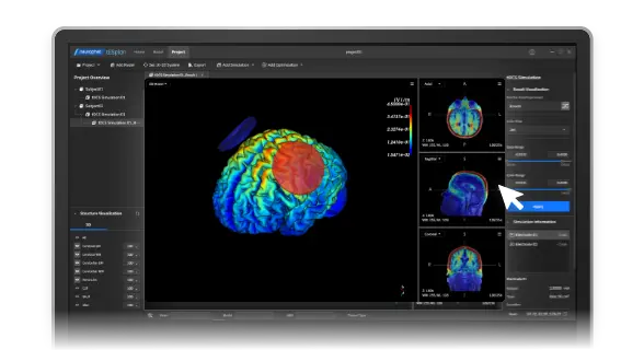 tES LAB personalized brain modeling